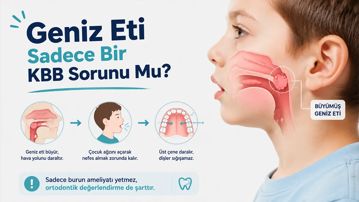 Geniz Eti Yüzü: Çocuğunuz Sürekli Ağzı Açık Mı Uyuyor? 4 cocuklarda agizdan nefes alma dis bozuklugu