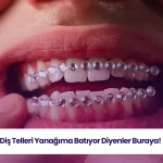 Diş teli batması durumunu ve oluşabilecek rahatsızlığı açıklayan görsel.