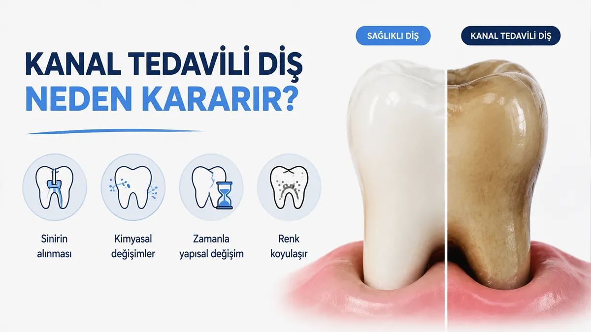 kararan dise kaplama mi beyazlatma mi