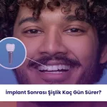 İmplant Sonrası Şişlik Kaç Gün Sürer? 3 İmplant sonrası şişlik, iyileşme sürecinde görülebilen normal bir postoperatif durumdur.