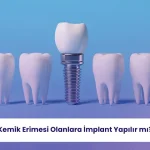 Kemik Erimesi Olanlara İmplant Yapılır mı? 3 Kemik erimesi implant tedavisini zorlaştırabilir ve ek cerrahi işlemler gerektirebilir.