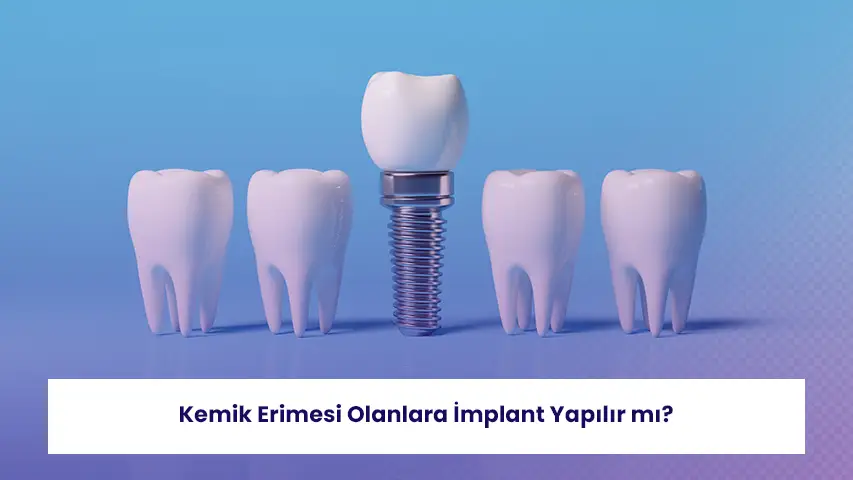 Kemik erimesi implant tedavisini zorlaştırabilir ve ek cerrahi işlemler gerektirebilir.