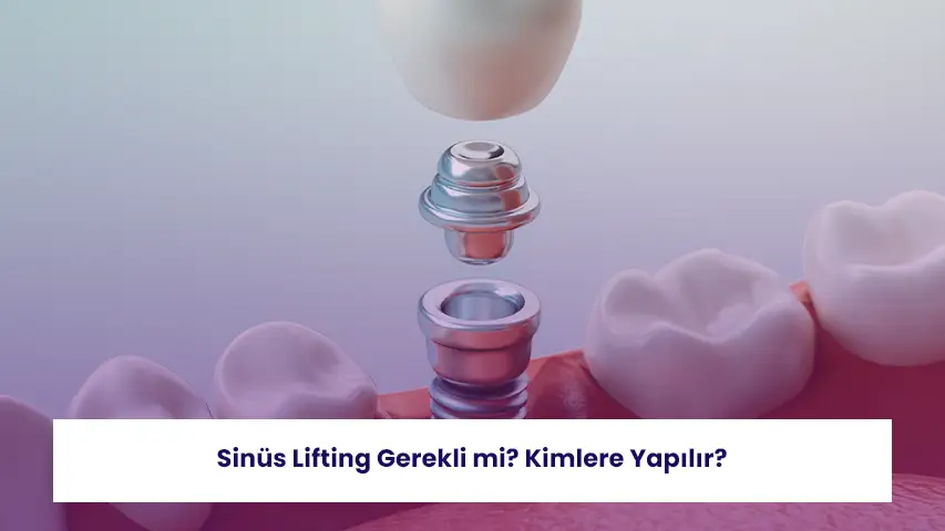 Sinüs lifting gerekli mi sorusu, implant tedavisi öncesi kemik yeterliliğini değerlendirir.