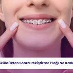 Diş teli söküldükten sonra retainer kullanımı ve nüks riskleri hakkında bilgilendirme görseli.