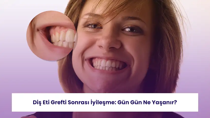 Diş Eti Grefti Sonrası İyileşme: Gün Gün Ne Yaşanır? 5 kapak copy
